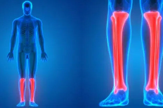 Как называются эти кости? Источник: https://ustaliy.ru/snax_quiz/test-po-anatomii-spravites-li-vy-s-voprosami-o-tele-cheloveka